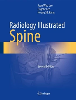 Abbildung von Lee / Kang | Radiology Illustrated: Spine | 2. Auflage | 2023 | beck-shop.de