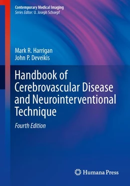 Abbildung von Harrigan / Deveikis | Handbook of Cerebrovascular Disease and Neurointerventional Technique | 4. Auflage | 2024 | beck-shop.de