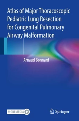 Abbildung von Bonnard | Atlas of Major Thoracoscopic Pediatric Lung Resection for Congenital Pulmonary Airway Malformation | 1. Auflage | 2023 | beck-shop.de