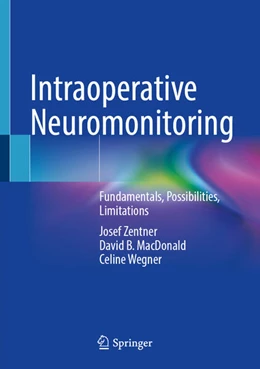Abbildung von Zentner / MacDonald | Intraoperative Neuromonitoring | 1. Auflage | 2024 | beck-shop.de