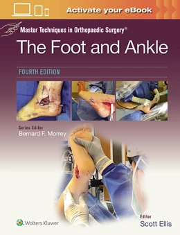 Abbildung von Ellis | Master Techniques in Orthopaedic Surgery: The Foot and Ankle: Print + eBook with Multimedia | 4. Auflage | 2024 | beck-shop.de