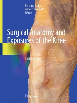 Abbildung von Zarins / Smigielski | Surgical Anatomy and Exposures of the Knee | 1. Auflage | 2024 | beck-shop.de