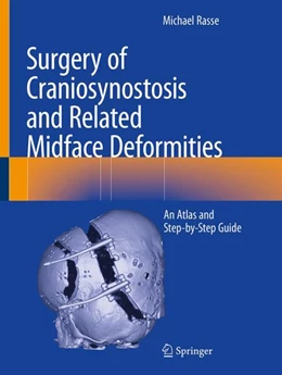 Abbildung von Rasse | Surgery of Craniosynostosis and Related Midface Deformities | 1. Auflage | 2024 | beck-shop.de