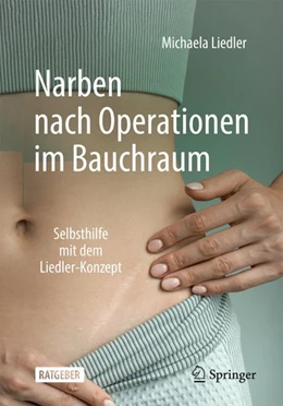 Abbildung von Liedler | Narben nach Operationen im Bauchraum | 1. Auflage | 2024 | beck-shop.de
