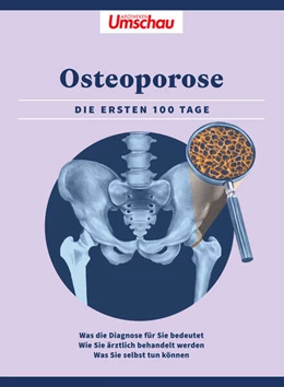 Abbildung von Wort & Bild Verlag | Apotheken Umschau: Osteoporose | 1. Auflage | 2024 | beck-shop.de