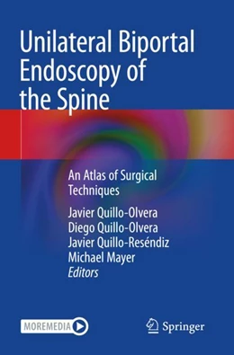 Abbildung von Quillo-Olvera / Quillo-Reséndiz | Unilateral Biportal Endoscopy of the Spine | 1. Auflage | 2023 | beck-shop.de