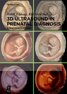 Abbildung von Chaoui / Heling | 3D Ultrasound in Prenatal Diagnosis | 2. Auflage | 2024 | beck-shop.de