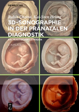 Abbildung von Chaoui / Heling | 3D-Sonographie in der pränatalen Diagnostik | 2. Auflage | 2024 | beck-shop.de