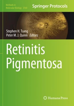 Abbildung von Tsang / Quinn | Retinitis Pigmentosa | 1. Auflage | 2023 | 2560 | beck-shop.de