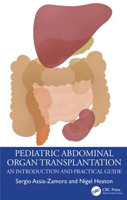 Abbildung von Heaton / Assia-Zamora | Pediatric Abdominal Organ Transplantation | 1. Auflage | 2024 | beck-shop.de