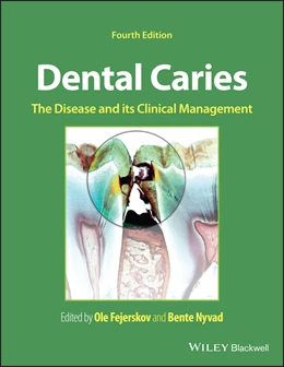 Abbildung von Fejerskov / Nyvad | Dental Caries | 4. Auflage | 2024 | beck-shop.de