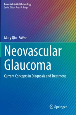 Abbildung von Qiu | Neovascular Glaucoma | 1. Auflage | 2023 | beck-shop.de
