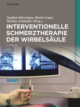Abbildung von Klessinger / Legat | Interventionelle Schmerztherapie der Wirbelsäule | 2. Auflage | 2024 | beck-shop.de