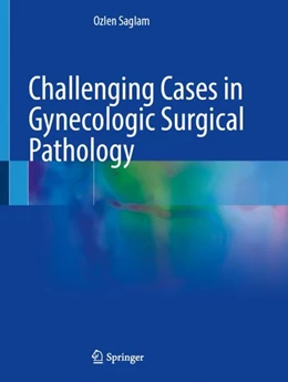 Abbildung von Saglam | Challenging Cases in Gynecologic Surgical Pathology | 1. Auflage | 2024 | beck-shop.de