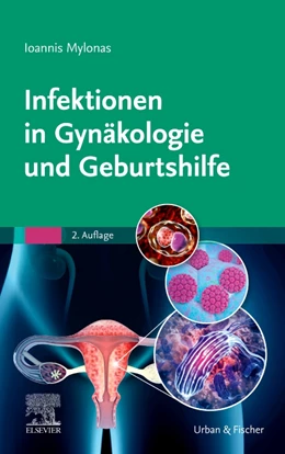 Abbildung von Mylonas | Infektionen in Gynäkologie und Geburtshilfe | 2. Auflage | 2024 | beck-shop.de