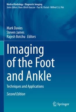 Abbildung von Davies / James | Imaging of the Foot and Ankle | 2. Auflage | 2023 | beck-shop.de