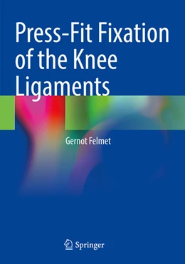 Abbildung von Felmet | Press-Fit Fixation of the Knee Ligaments | 1. Auflage | 2024 | beck-shop.de