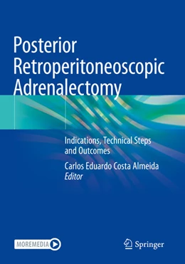 Abbildung von Eduardo Costa Almeida | Posterior Retroperitoneoscopic Adrenalectomy | 1. Auflage | 2024 | beck-shop.de