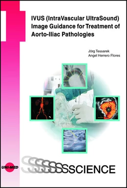 Abbildung von Tessarek / Herrero Flores | IVUS (IntraVascular UltraSound) Image Guidance for Treatment of Aorto-Iliac Pathologies | 1. Auflage | 2024 | beck-shop.de