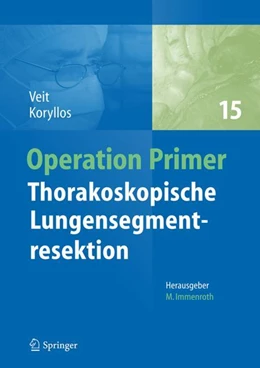 Abbildung von Veit / Koryllos | Thorakoskopische Lungensegmentresektion | 1. Auflage | 2024 | beck-shop.de