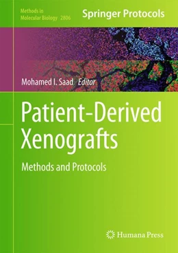 Abbildung von Saad | Patient-Derived Xenografts | 1. Auflage | 2024 | 2806 | beck-shop.de