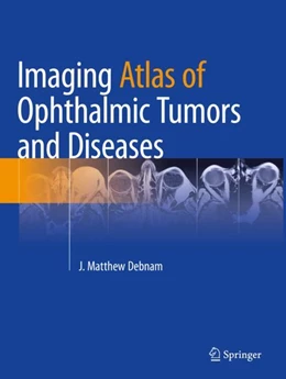 Abbildung von Debnam | Imaging Atlas of Ophthalmic Tumors and Diseases | 1. Auflage | 2024 | beck-shop.de