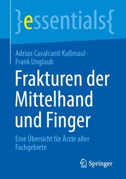 Abbildung von Cavalcanti Kußmaul / Unglaub | Frakturen der Mittelhand und Finger | 1. Auflage | 2024 | beck-shop.de