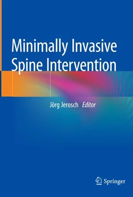 Abbildung von Jerosch | Minimally Invasive Spine Intervention | 1. Auflage | 2024 | beck-shop.de