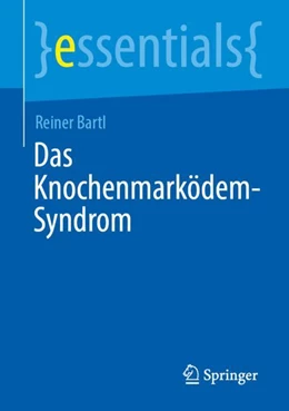 Abbildung von Bartl | Das Knochenmarködem-Syndrom | 1. Auflage | 2024 | beck-shop.de