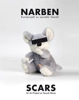 Abbildung von Moser / Wassermann | Narben/Scars | 1. Auflage | 2013 | beck-shop.de