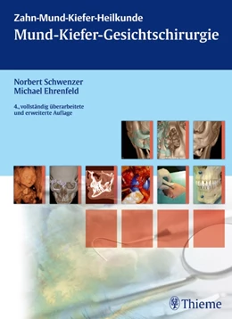 Abbildung von Schwenzer / Ehrenfeld | Mund-Kiefer-Gesichtschirurgie | 4. Auflage | 2010 | beck-shop.de