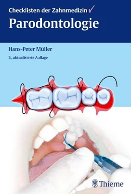 Abbildung von Müller | Checklisten der Zahnmedizin • Parodontologie | 3. Auflage | 2012 | beck-shop.de